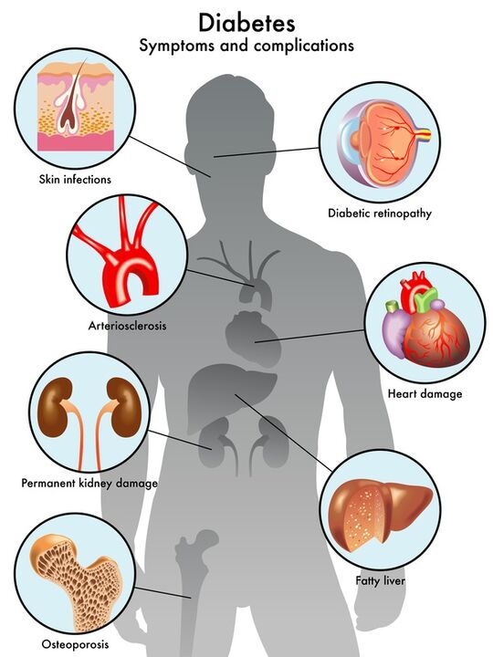Insuvit protege los órganos objetivo de las complicaciones
